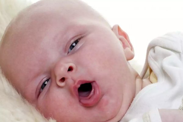 Bebeklerde Öksürük Nedenleri ve Tedavisi